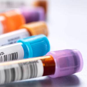 Blood Control Solutions